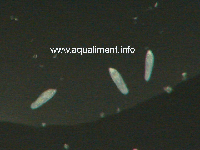 Groupe de trois paramécies
Les paramécies se nomment également ciliés, la taille est inférieure   0.1 mm donc   peine visible   l'oeil . 

Prise de vue faite par marc
Mots-clés: paramécies paramécie infusoire protozoaire cilié unicellulaire élevage proie reproduction alimentation vivante nourriture